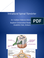 Ntradural Spinal Tmrler DR Fuldem Yldrm Dnmez Bakent Niversitesi Radyoloji Anabilim Dal Ankara