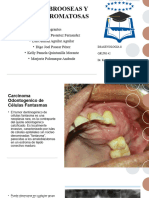 Lesiones Fibrooseas y Osteocondromatosas