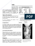 Esophageal Atresia