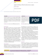 Pitiriasis Versicolor Hipercrómica: Informe de Cinco Casos: Pityriasis Versicolor. Report of Five Cases