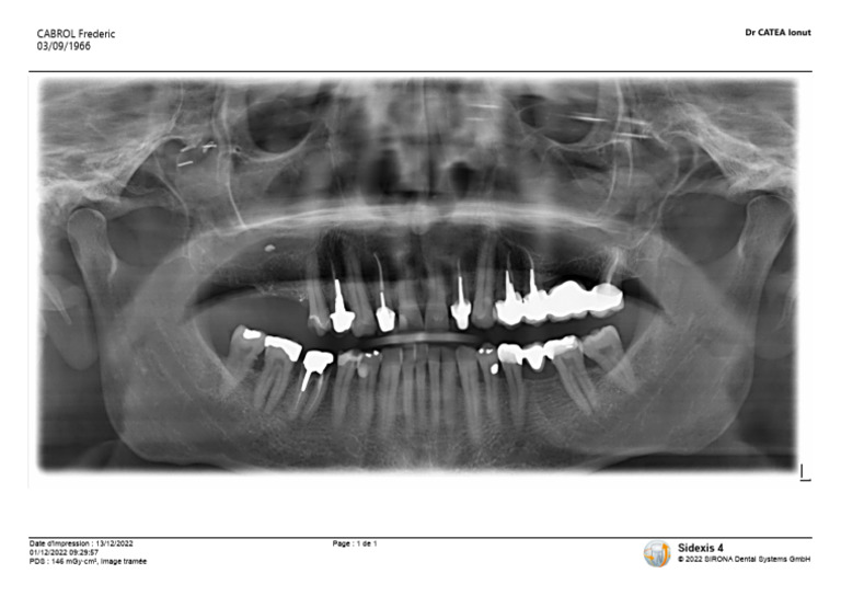 Radiographie Panoramique Du | PDF
