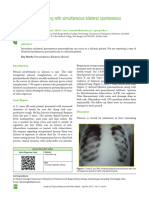 Silicosis Presenting With Simultaneous Bilateral Spontaneous Pneumothorax