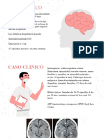 Caso Clinico Neuroradiología