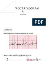 Electrocardiogram A