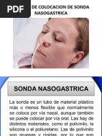 Sonda Nasogastrica