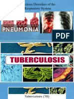 TB Pneumonia 1
