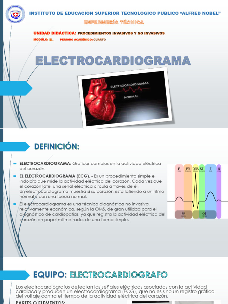 ELECTROCARDIOGRAMA | PDF | Electrocardiografia | Infarto de miocardio