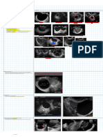 Lesiones No Neoplasicas