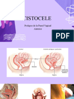 Cistocele 1