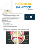 Polyarthrite Rhumatoïde