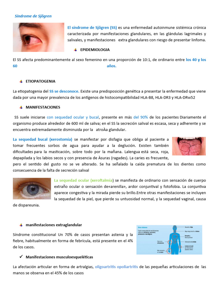 Síndrome De Sjögren Pdf Medicina Clinica Enfermedades Y