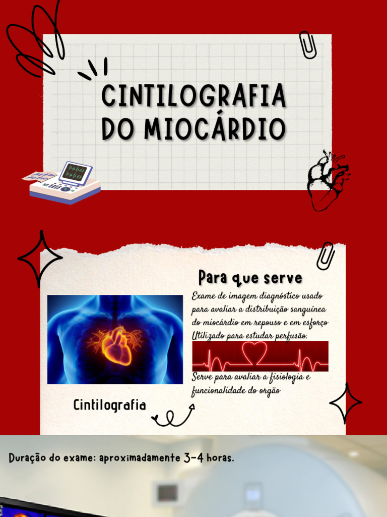 Cintilografia Do Miocárdio | PDF | Coração | Especialidades médicas