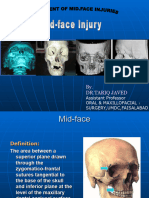 Mid-Face Injury