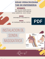 Instalacion de Sonda Nasogatrica