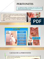 Peritonitis