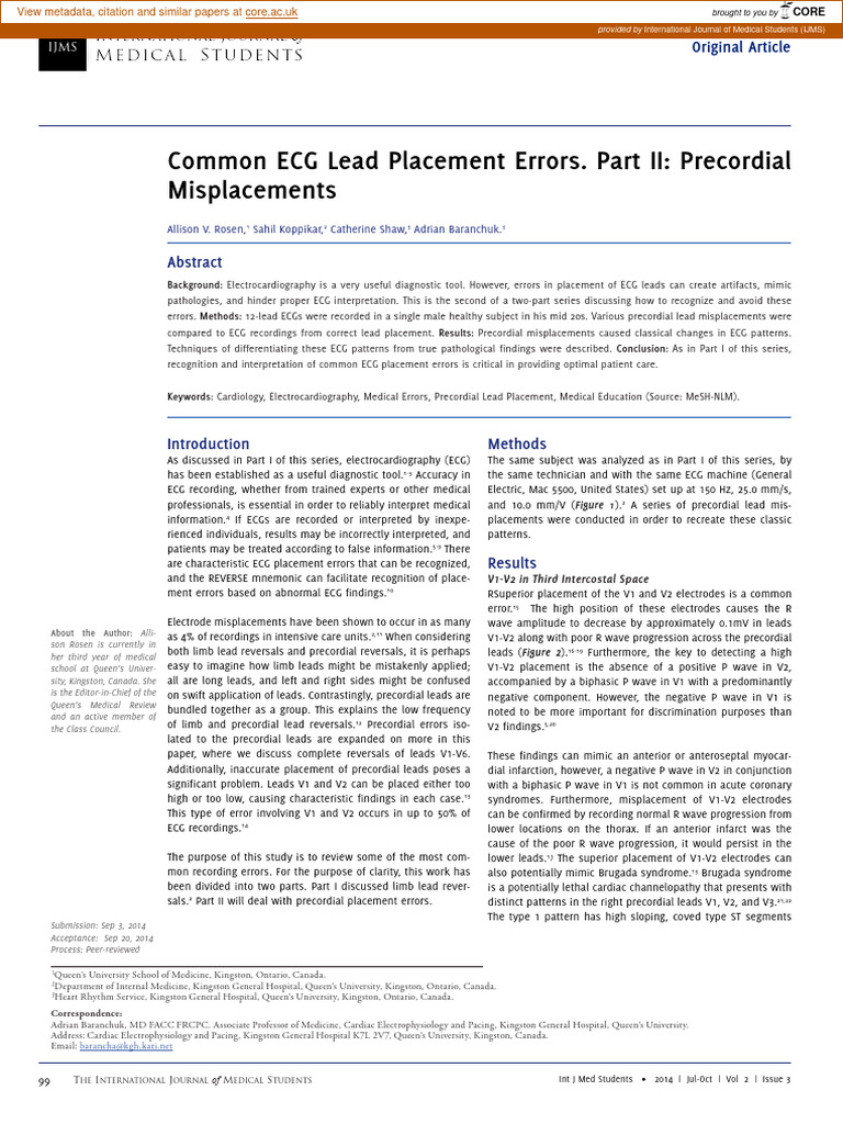 Common ECG Lead Placement Errors. Part II: Precordial Misplacements ...