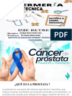 Cancer A La Prostata