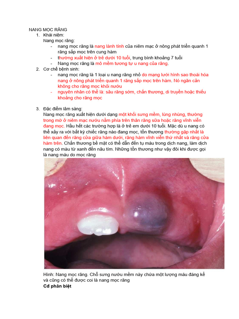 NANG MỌC RĂNG | PDF