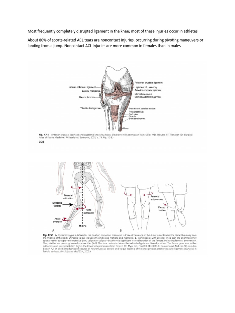 ACL Brotzman | PDF | Knee | Causes Of Death