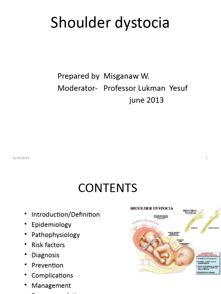 Shoulder Dystocia PDF Childbirth Pelvis