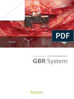 GBR System