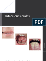 UNIDAD 1 Infecciones Orales