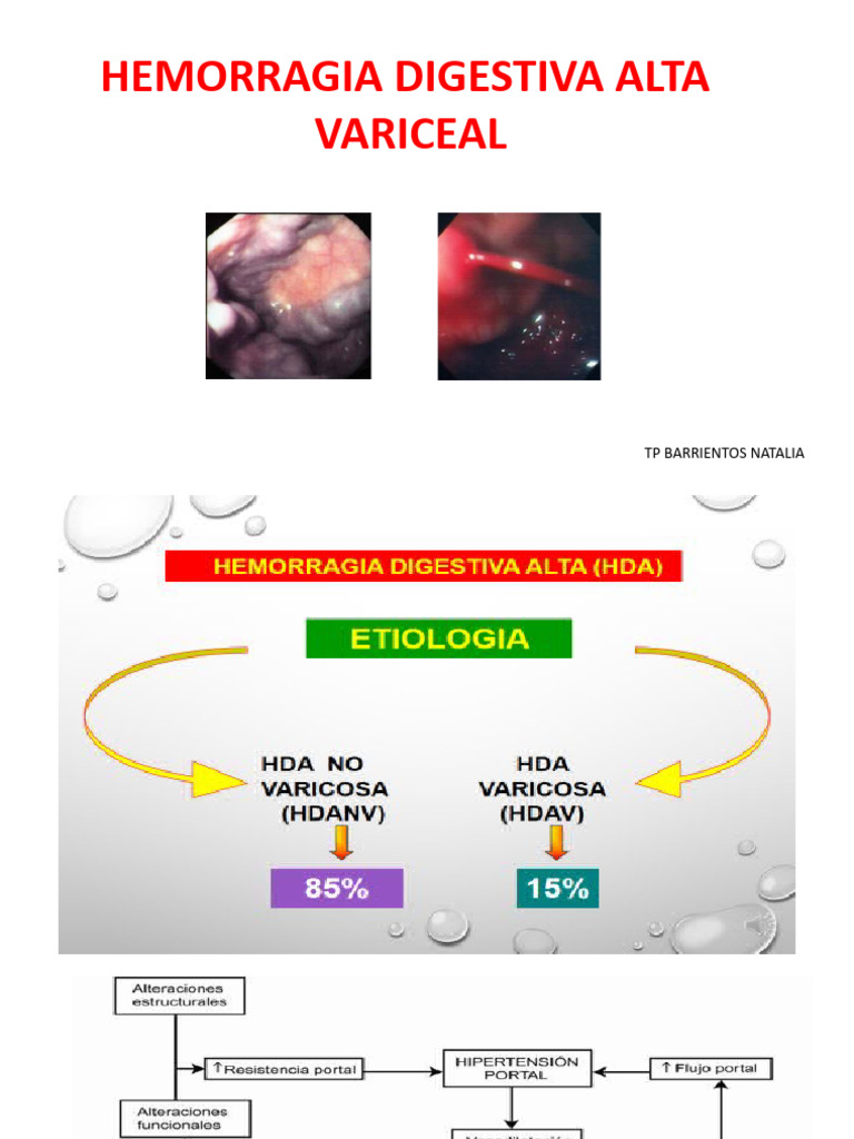 Manejo de Hemorragia Digestiva Alta Variceal | PDF | Medicina CLINICA ...