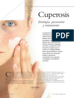 Cuperosis Etiología Prevención y Tratamiento
