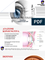 KONJUNGTIVITIS