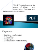 Endoscopic Third Ventriculostomy For The Management of Chiari