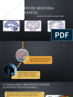 Intervencion de Segunda Instancia