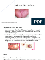 Imperforación Del Ano