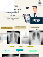 Pasos para Interpretar Una Radiografía de Tórax