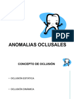 Anomalias Oclusales