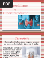 Tireoide
