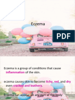 Eczema