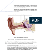 Prolonged Exposure To Loud Noise Can Cause Damage of Hair