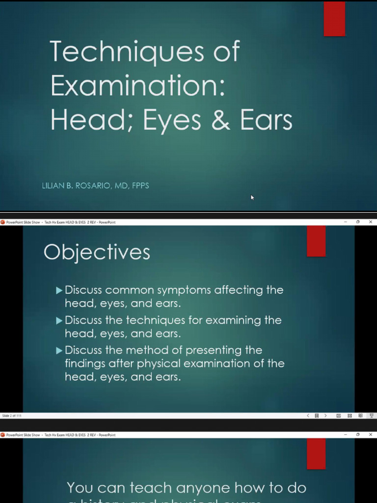 Eyes | PDF