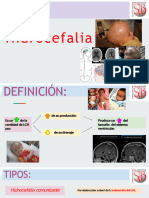 HIDROCEFALIA