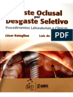 Ajuste Oclusal Por Desgaste Seletivo