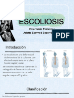 E Scoliosis