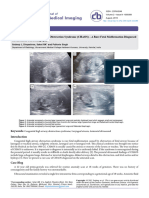 Congenital High Airway Obstruction Syndrome Chaos A Rare Fetal Malformation Diagnosed On Antenatal Ultrasonography