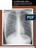 CHEST X-RAYS -CASE- British Institute of Radiology