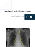 NKJD AnswersHeart and Mediastinum Images-1