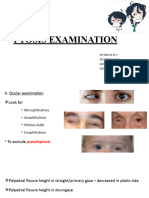 Ptosis Examination