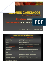 Tumores Cardíacos