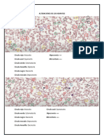 ALTERACIONES (Anemia Falciforme)