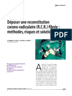 Déposer Une Reconstitution Corono-Radiculaire Fibrée