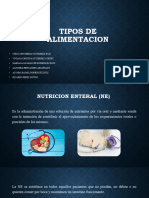 Tipos de Alimentacion