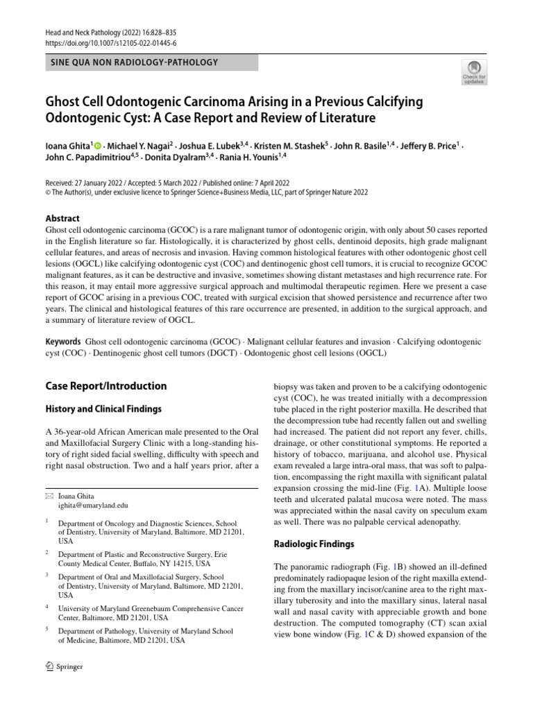 Ghost cell odontogenic carcinoma arising in a previous calcifying cyst